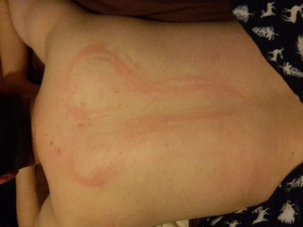 It looks like my boyfriend has sex scratches on his back but he swears he  has